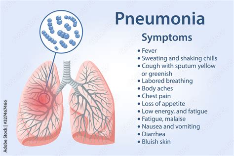 what diseases are similar to pneumonia
